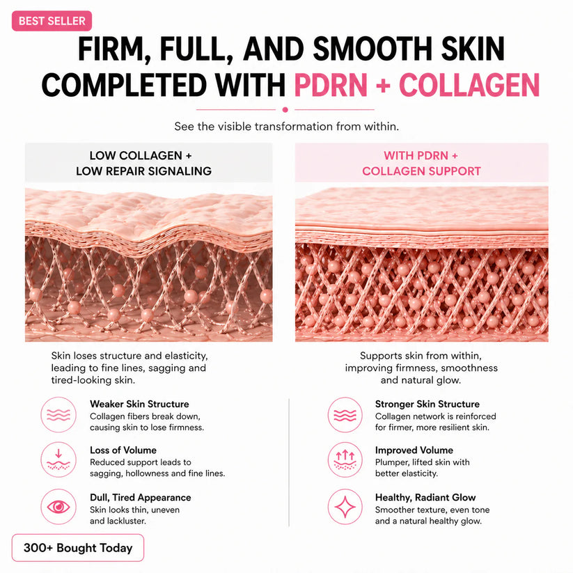🔥LAST DAY 60% OFF Zorevyn Korean Pink CollagenVolume Multi Balm